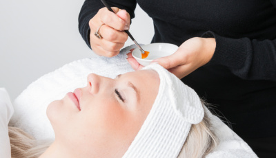 Risks and Dangers of At-Home Peels