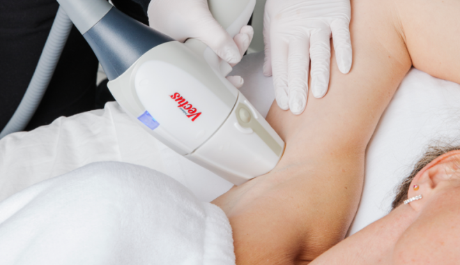 Your Guide to Laser Hair Removal