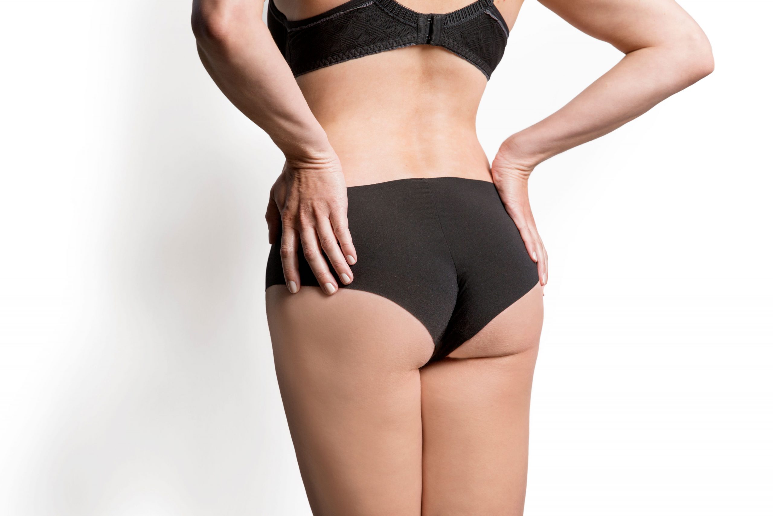 Buttock Augmentation – Fat Transfer vs. Implants