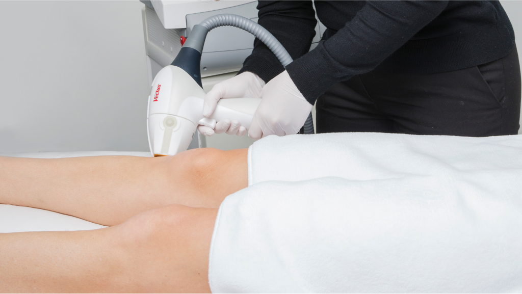 How Many Sessions for Laser Hair Removal?