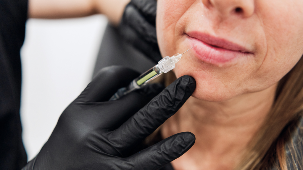 How Much Is Lip Filler?